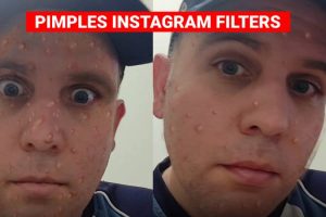Pimples Instagram filter – Virtual pimples on your face!